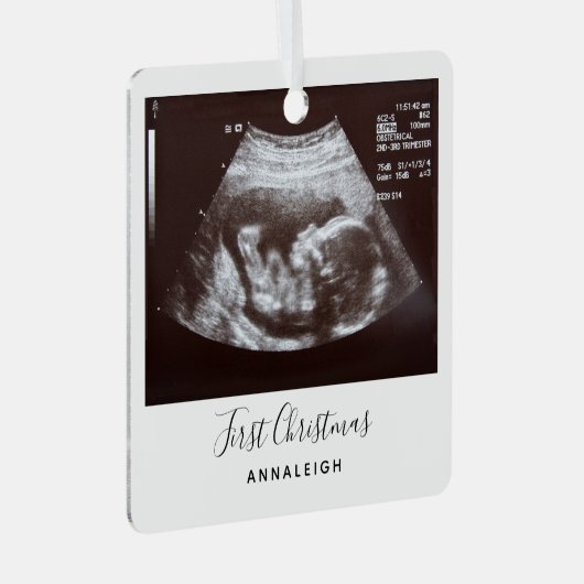 Ultrasound eerste kerstfeestdag metalen ornament (Voorkant Rechts)