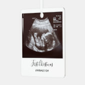 Ultrasound eerste kerstfeestdag metalen ornament (Voorkant links)