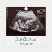 Ultrasound eerste kerstfeestdag metalen ornament (Achterkant)