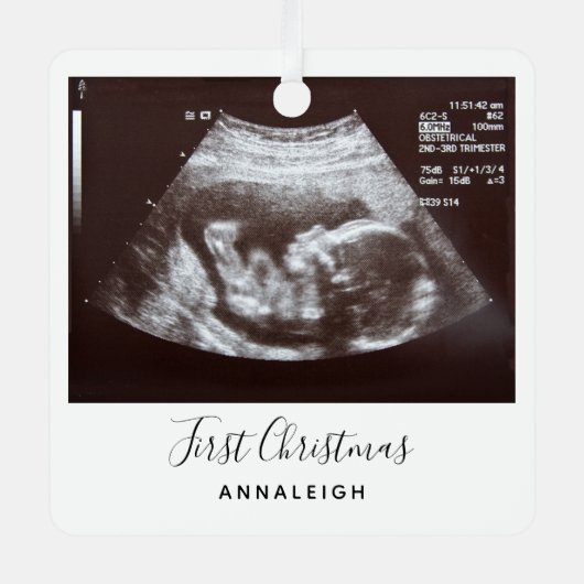 Ultrasound eerste kerstfeestdag metalen ornament (Voorkant)