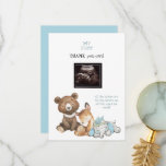 Ultrasound Foto Animal Funny Dank u Baby Bedankkaart<br><div class="desc">Ultrasound Foto Baby shower - Hartelijk dank. Baby's perspectief. Dank u van de Baby. Bouw. Jongen. Slapende dieren. Blauw.</div>