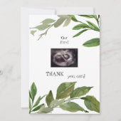 Ultrasound Foto Bedankt Twins Viewpoint Foliage (Voorkant)