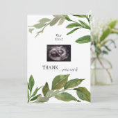 Ultrasound Foto Bedankt Twins Viewpoint Foliage (Staand voorkant)