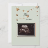 Ultrasound foto Dank je grappigheid Bedankkaart (Voorkant)