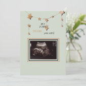 Ultrasound foto Dank je grappigheid Bedankkaart (Staand voorkant)