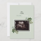 Ultrasound Foto Dank u Baby Punt van Uitzicht II Bedankkaart (Voorkant)