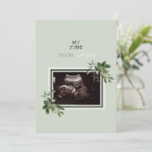 Ultrasound Foto Dank u Baby Punt van Uitzicht II Bedankkaart (Staand voorkant)