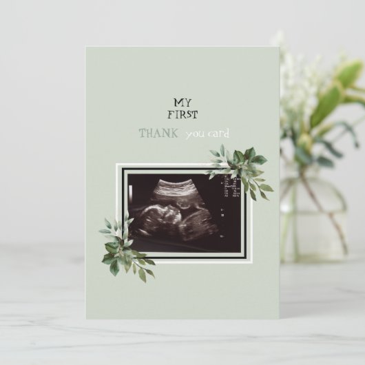 Ultrasound Foto Dank u Baby Punt van Uitzicht II Bedankkaart (Staand voorkant)