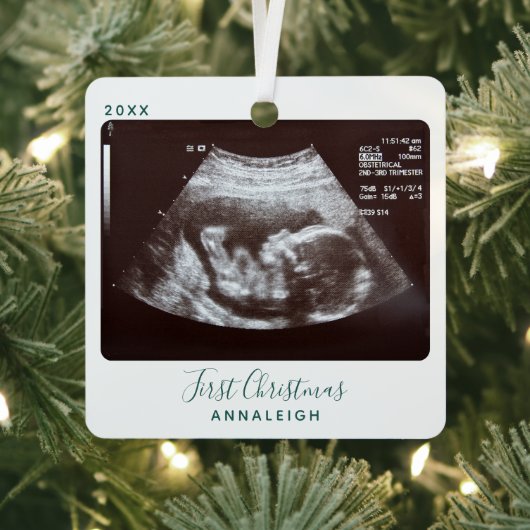 Ultrasound Foto Eerste Kerstmis Sonogram Holiday Metalen Ornament (Insitu)
