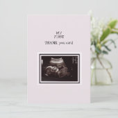 Ultrasound Foto roze Hartelijk dank Baby Bedankkaart (Staand voorkant)