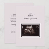 Ultrasound Foto roze Hartelijk dank Baby Bedankkaart (Voorkant / Achterkant)