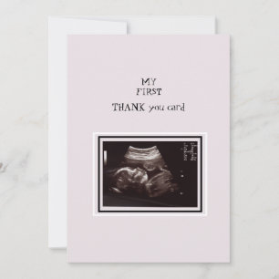 Ultrasound Foto roze Hartelijk dank Baby Bedankkaart