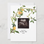 Ultrasound Foto Sunflower Hartelijk dank Bedankkaart (Voorkant)