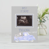 Ultrasound foto Truck Bedankt Baby Point of Uitzic (Staand voorkant)