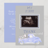 Ultrasound foto Truck Bedankt Baby Point of Uitzic (Voorkant / Achterkant)