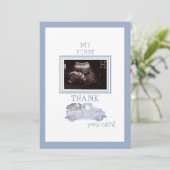 Ultrasound Foto Truck Bedankt Blue Baby View (Staand voorkant)