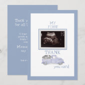 Ultrasound Foto Truck Bedankt Blue Baby View (Voorkant / Achterkant)
