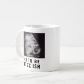 Ultrasound Foto van papa om koffie te Mokken (Voorkant links)