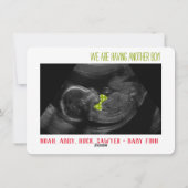 Ultrasound fotokaart jongen geslacht onthulling va feestdagenkaart (Achterkant)