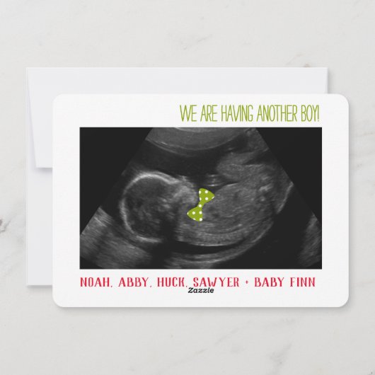 Ultrasound fotokaart jongen geslacht onthulling va feestdagenkaart (Achterkant)