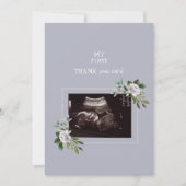 Ultrasound Fotomeisje Dank u Baby Uitzicht Bedankkaart (Voorkant)