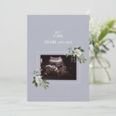 Ultrasound Fotomeisje Dank u Baby Uitzicht Bedankkaart (Staand voorkant)