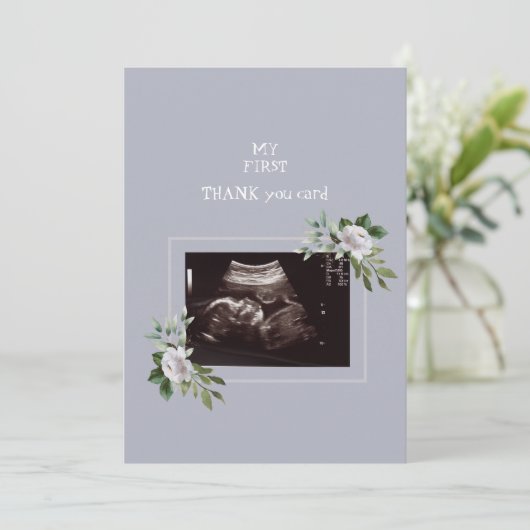 Ultrasound Fotomeisje Dank u Baby Uitzicht Bedankkaart (Staand voorkant)