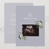 Ultrasound Fotomeisje Dank u Baby Uitzicht Bedankkaart (Voorkant / Achterkant)