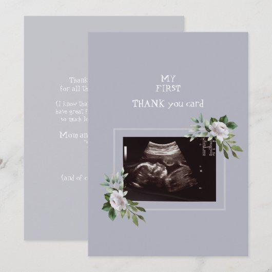Ultrasound Fotomeisje Dank u Baby Uitzicht Bedankkaart (Voorkant / Achterkant)