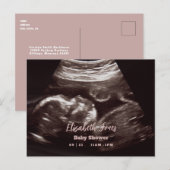 Ultrasound Fotoroze Baby shower Aankondigingskaart (Voorkant / Achterkant)