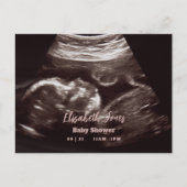 Ultrasound Fotoroze Baby shower Aankondigingskaart (Voorkant)