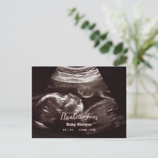 Ultrasound Fotoroze Baby shower Aankondigingskaart (Staand voorkant)