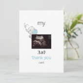 Ultrasound Funny 1st Hartelijk dank Baby Uitzicht Bedankkaart (Staand voorkant)