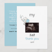 Ultrasound Funny 1st Hartelijk dank Baby Uitzicht Bedankkaart (Voorkant / Achterkant)
