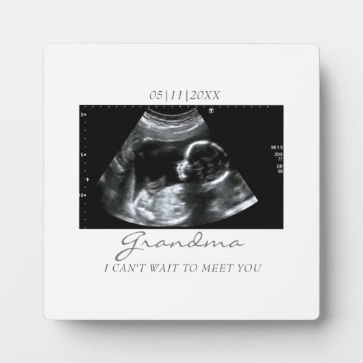 Ultrasound Gifts for Grandma Sonogram Baby Foto Fotoplaat (Voorkant)