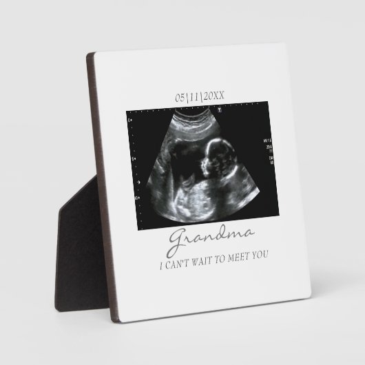 Ultrasound Gifts for Grandma Sonogram Baby Foto Fotoplaat (Voorkant)