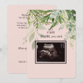 Ultrasound Girl Dank je Baby Punt van Uitzicht Bedankkaart (Voorkant / Achterkant)