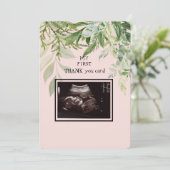 Ultrasound Girl Dank je Baby Punt van Uitzicht Bedankkaart (Staand voorkant)