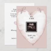 Ultrasound hart & vlinder grappig bedankt (Voorkant / Achterkant)