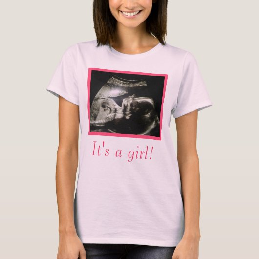 Ultrasound moederschap T-shirt om aan te passen (Voorkant)