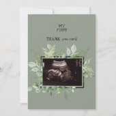 Ultrasound Sage Dank u voor uw Baby kijkpunt Bedankkaart (Voorkant)