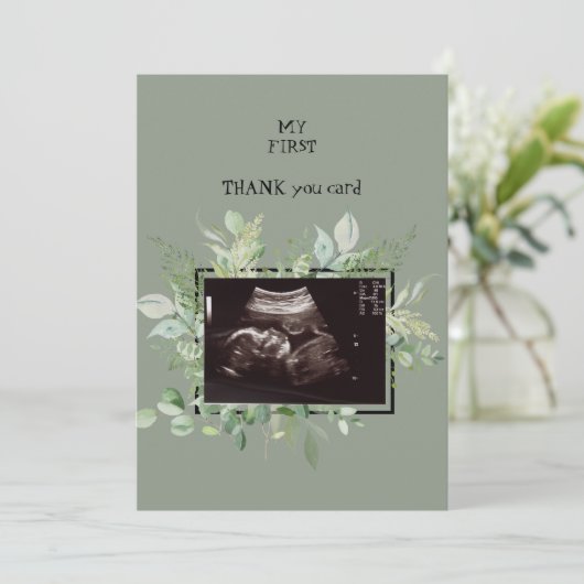 Ultrasound Sage Dank u voor uw Baby kijkpunt Bedankkaart (Staand voorkant)