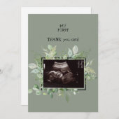 Ultrasound Sage Dank u voor uw Baby kijkpunt Bedankkaart (Voorkant / Achterkant)