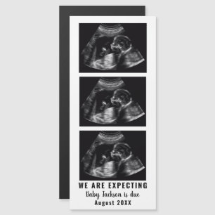 Ultrasound Zwangerschapsaankondiging Foto Magneet
