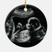 Ultrasound zwangerschapsaankondiging Kerstmis Keramisch Ornament (Achterkant)