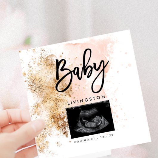 Unieke Sonogram Binnenkort verkrijgbaar Nieuwe bab Aankondiging