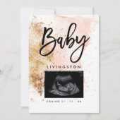 Unieke Sonogram Binnenkort verkrijgbaar Nieuwe bab Aankondiging (Voorkant)