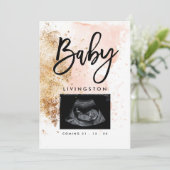 Unieke Sonogram Binnenkort verkrijgbaar Nieuwe bab Aankondiging (Staand voorkant)