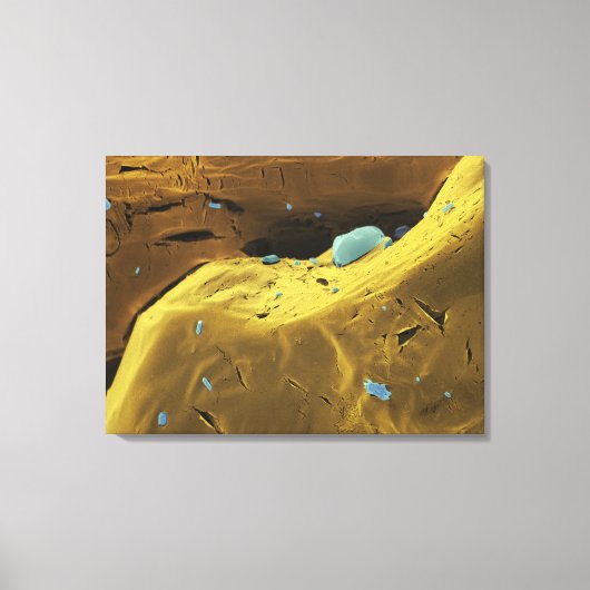 Ureumpoeder Canvas Afdruk (Voorkant)