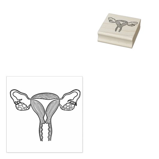 Uterus Birth Rubberstempel (Gestempeld)